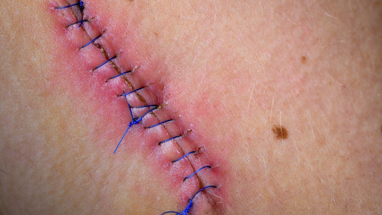 Las 10 lesiones de espalda más comunes (causas, síntomas y