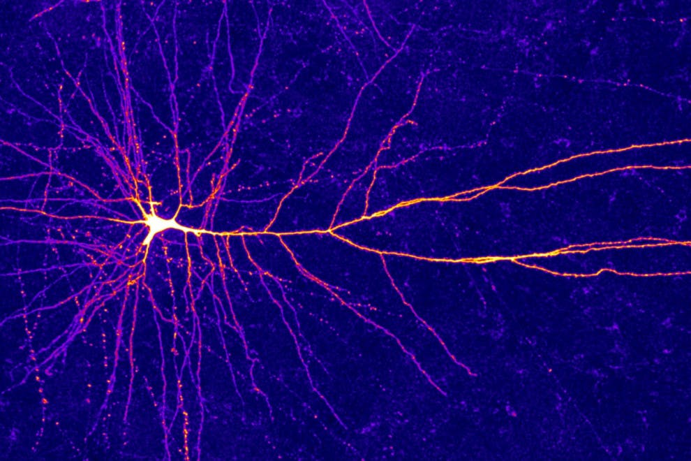 Como funciona una neurona