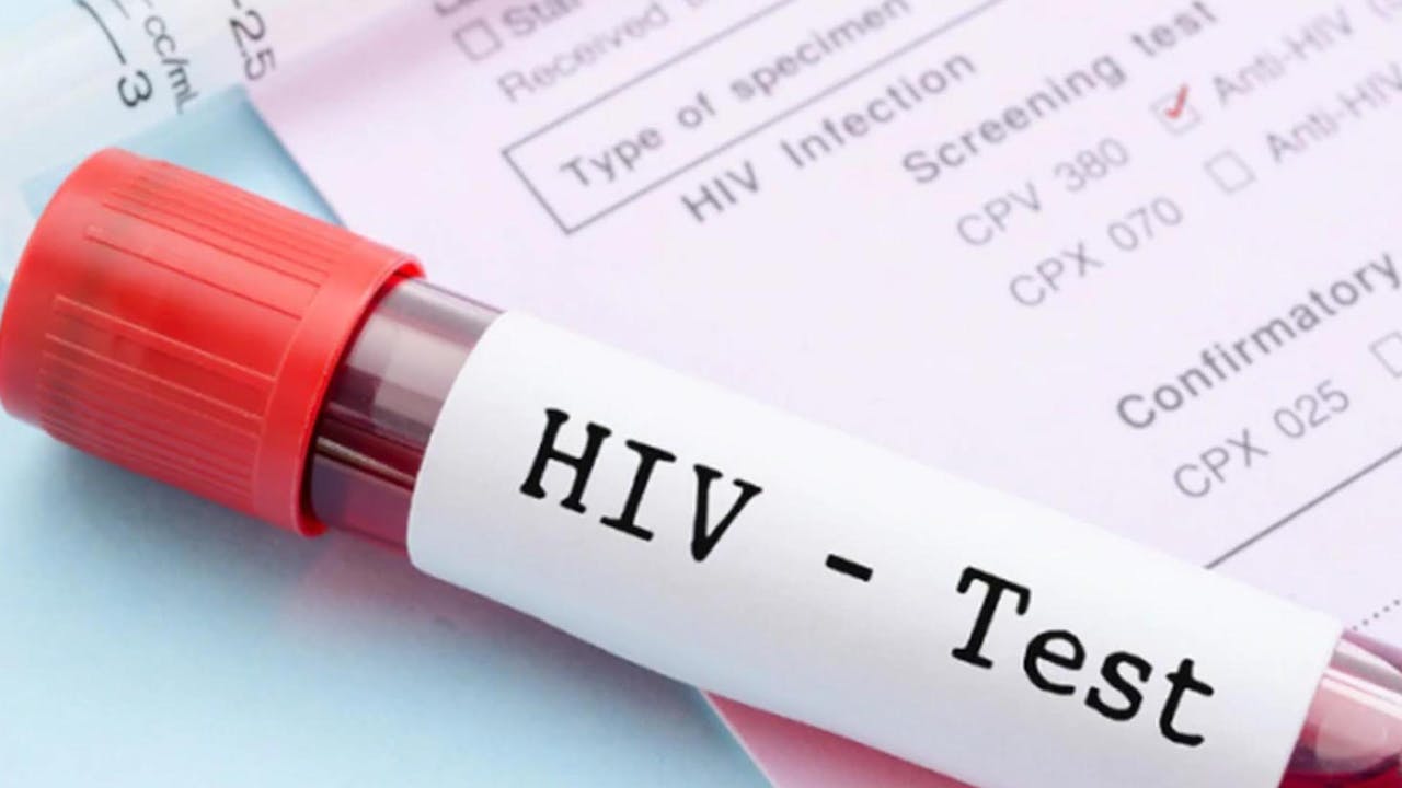 Carga viral VIH
