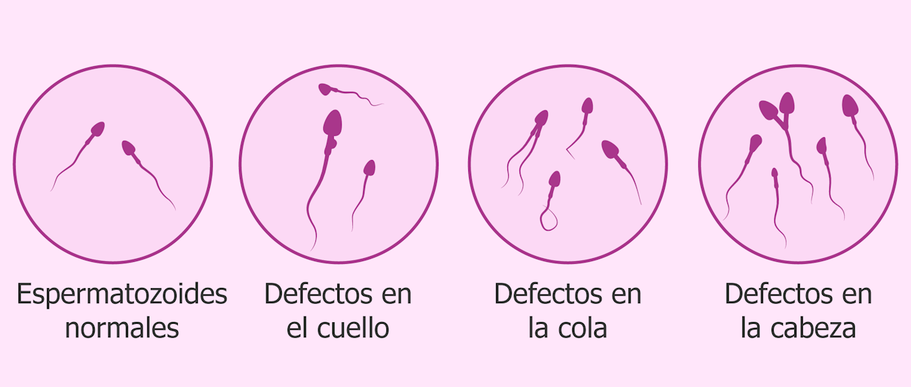 Espermatogénesis maduración