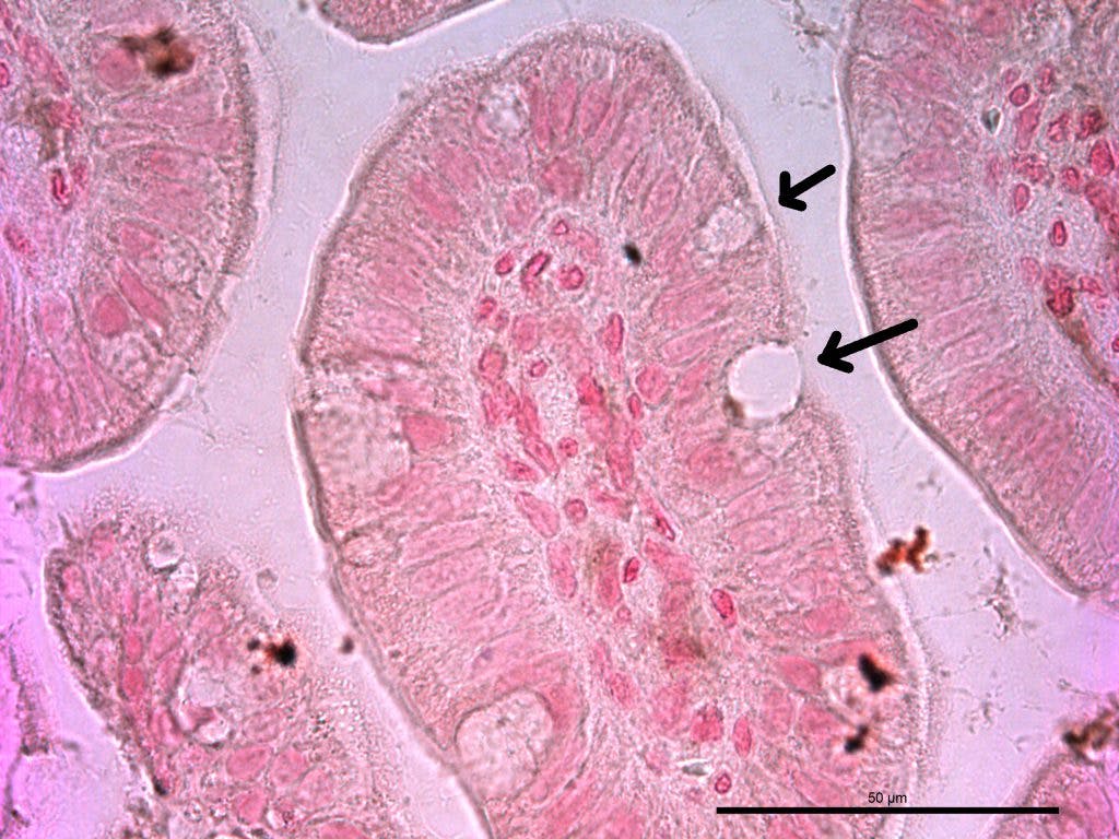 Células caliciformes