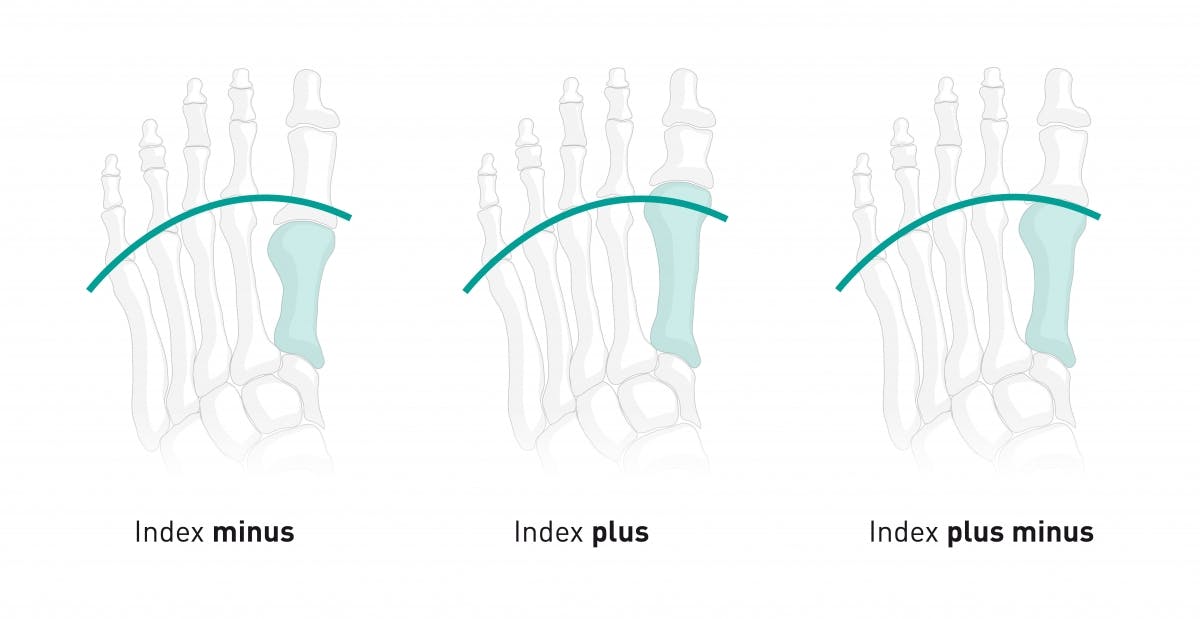 Tipos pies index