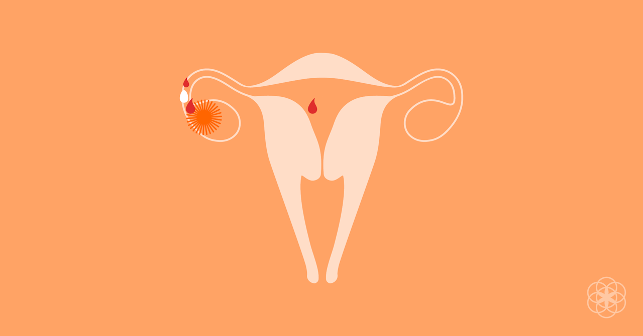 Síntomas cáncer endometrio