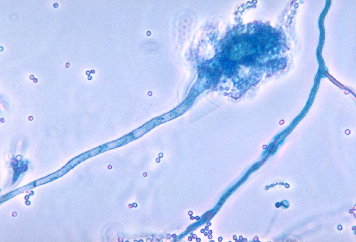 Aspergillus fumigatus causas