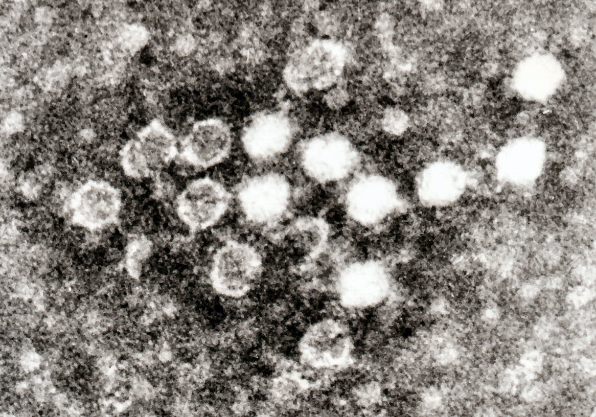 Virus ADN monocatenario