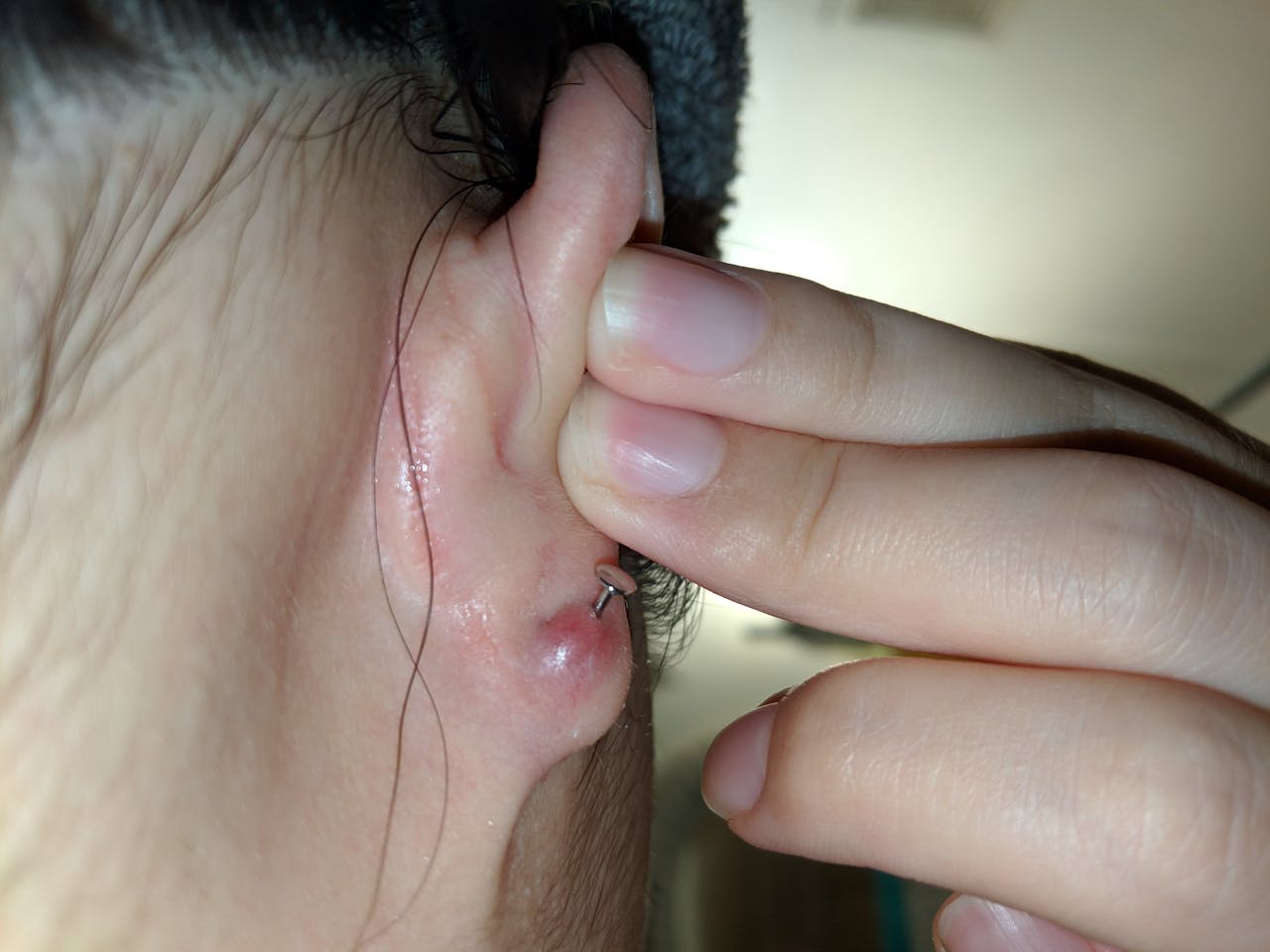 piercing-infectado