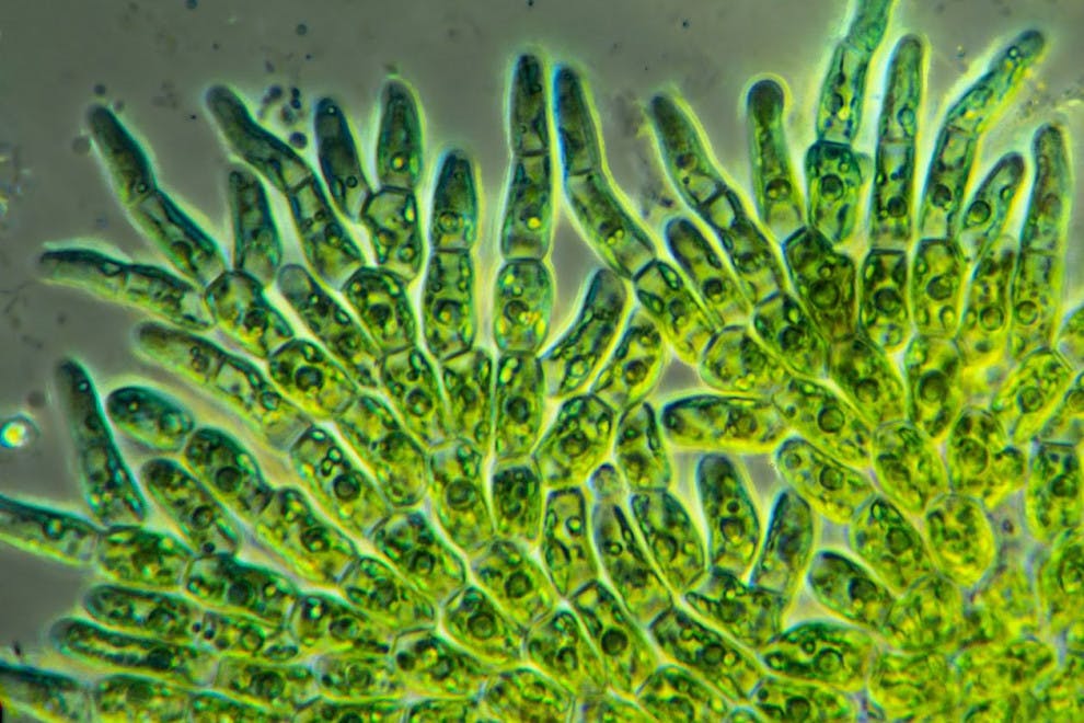 diferencias-algas-protozoos